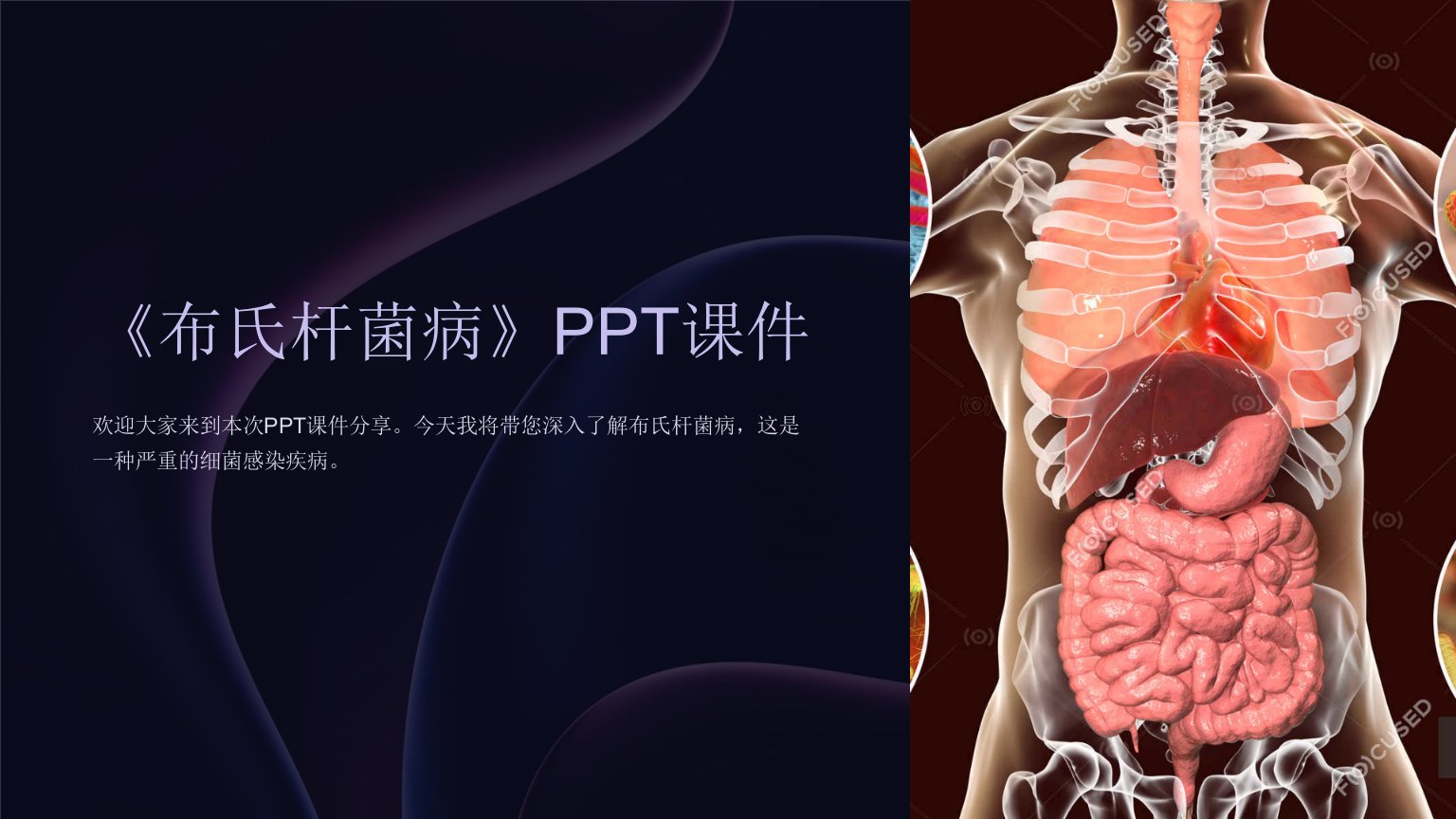 《布氏杆菌病》课件