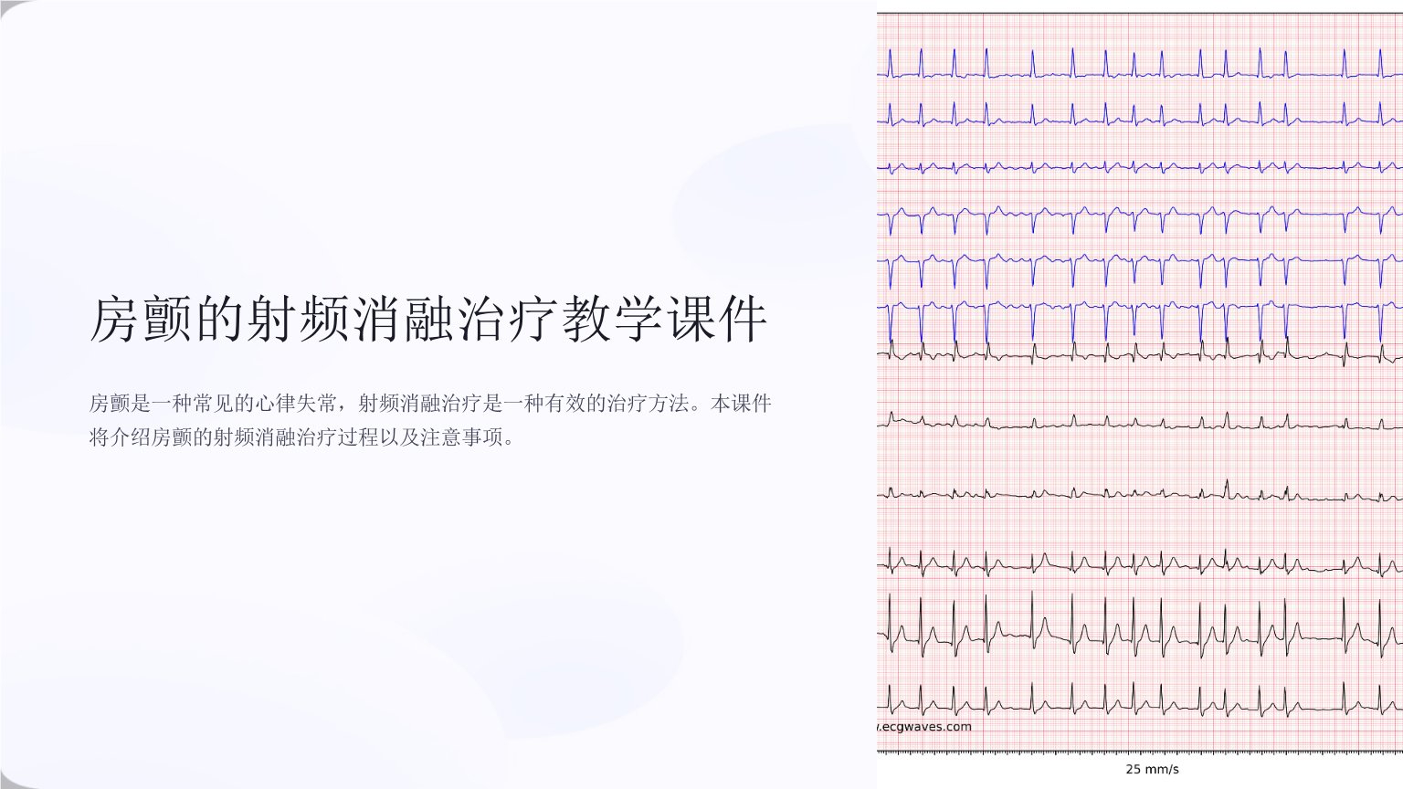 房颤的射频消融治疗教学课件