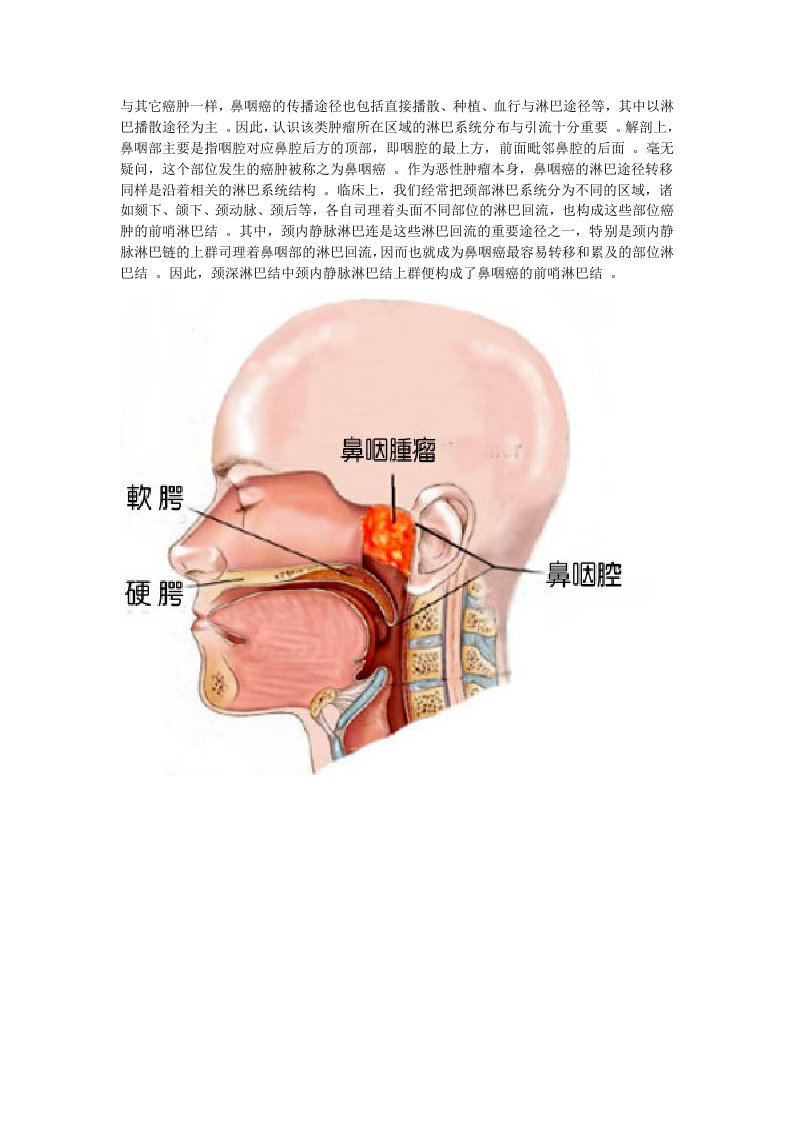 鼻咽癌的颈部淋巴结转移.总结