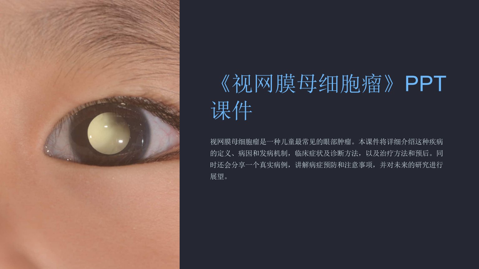 《视网膜母细胞瘤》课件