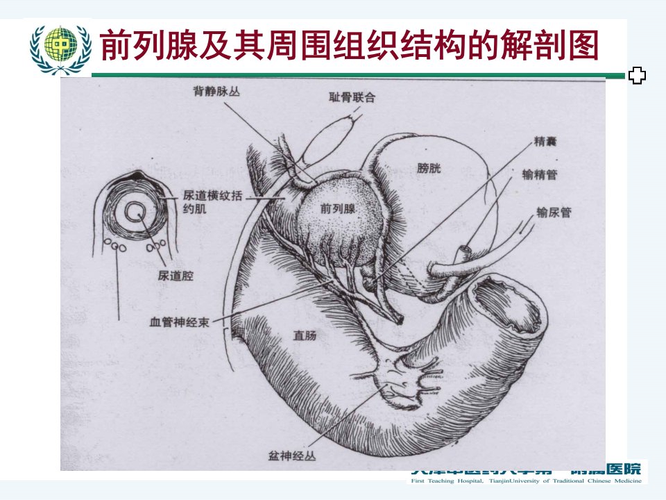 前列腺癌新研究概述