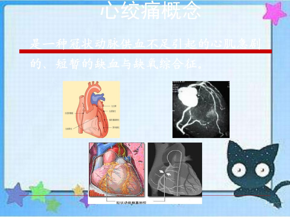 抗心绞痛药课件2