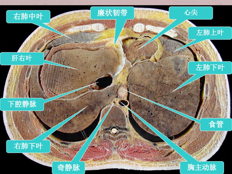 腹部的横断层解剖