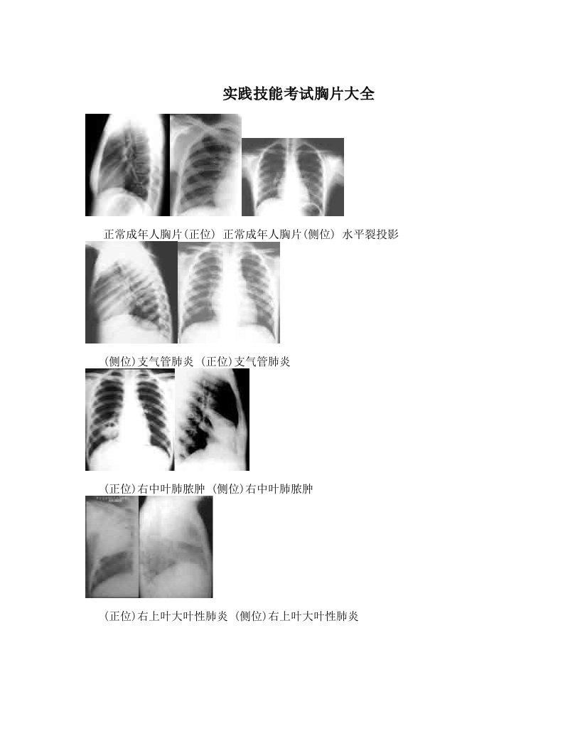 实践技能考试胸片大全