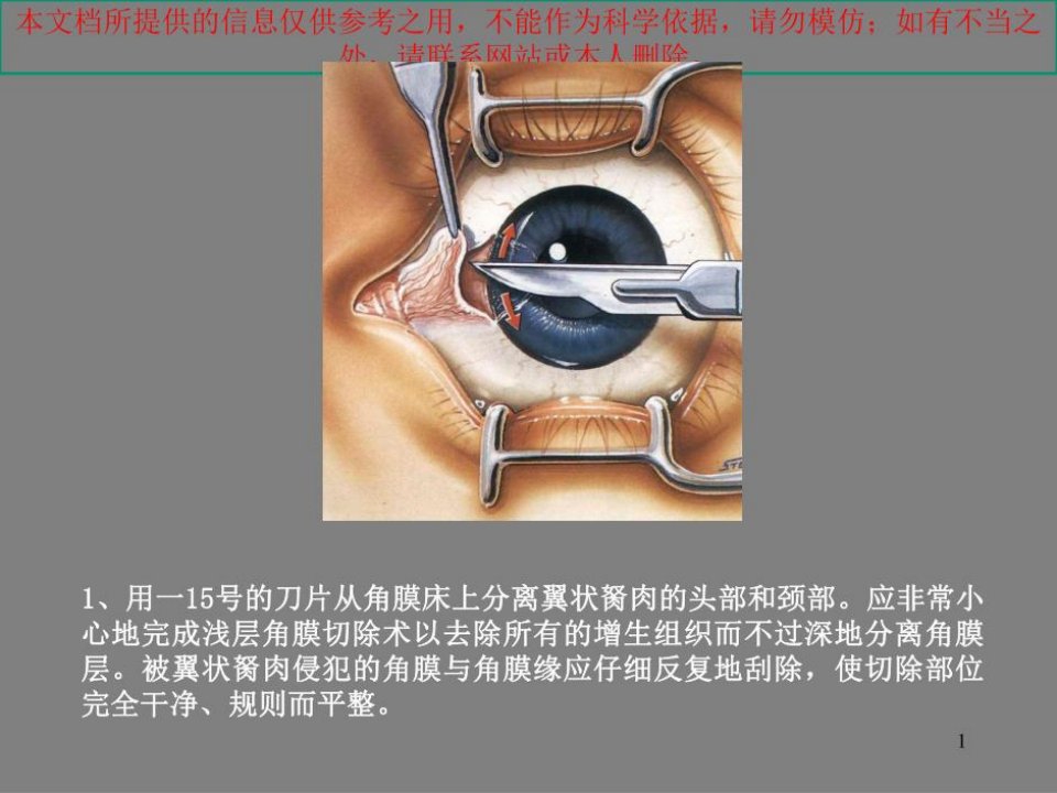 翼状胬肉的手术