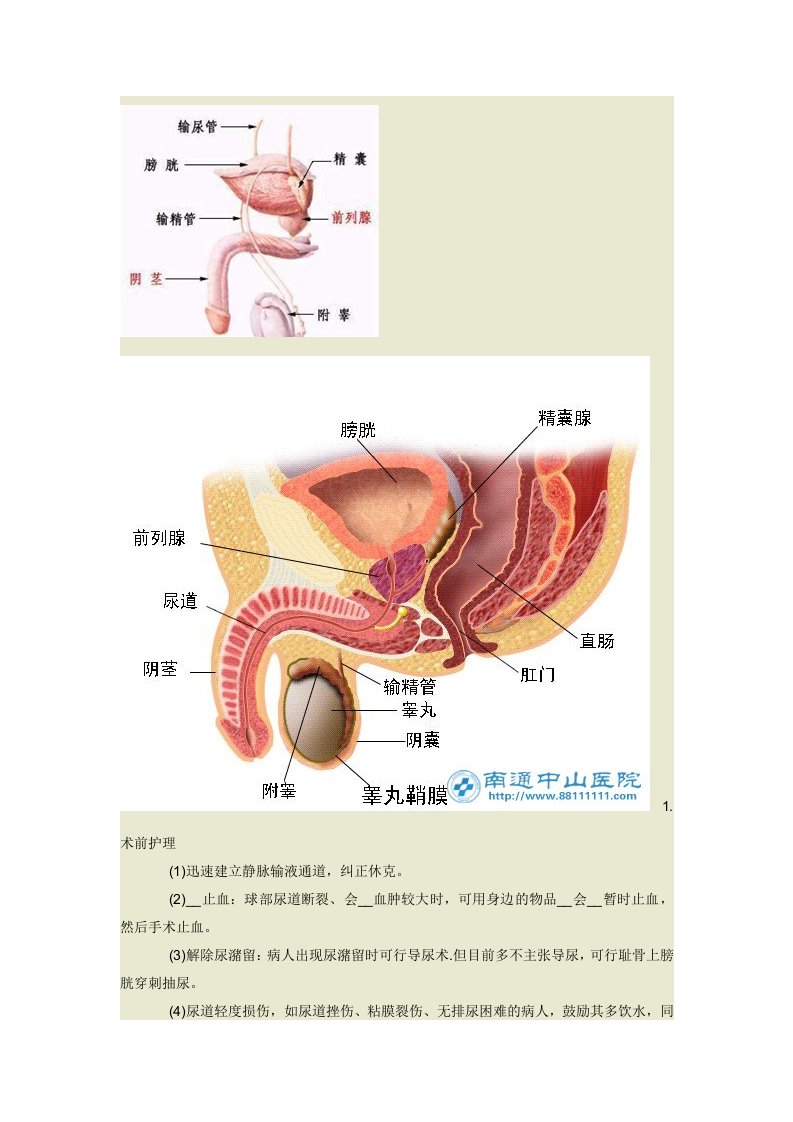 尿道损伤护理