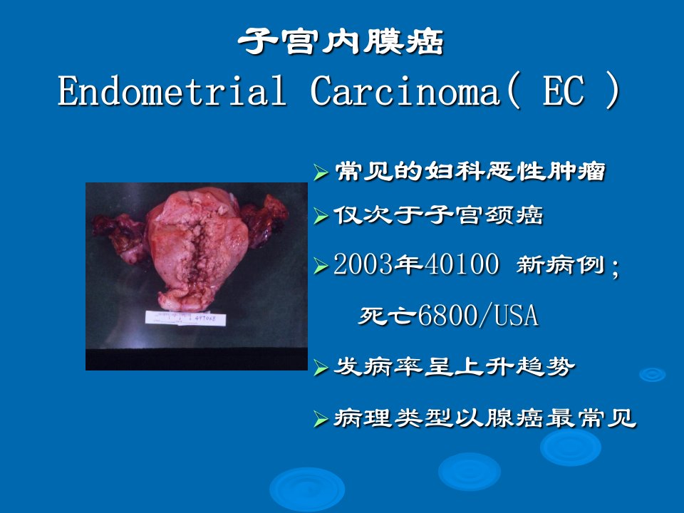 妇产科子宫内膜癌(教学)ppt课件