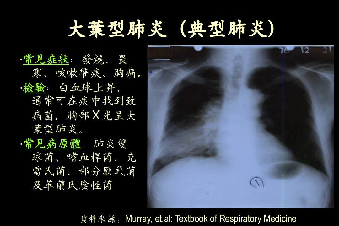 医学专题严重急性呼吸道症候群