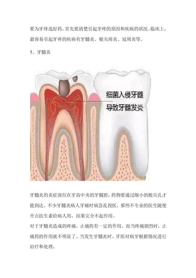 牙痛的用药技巧