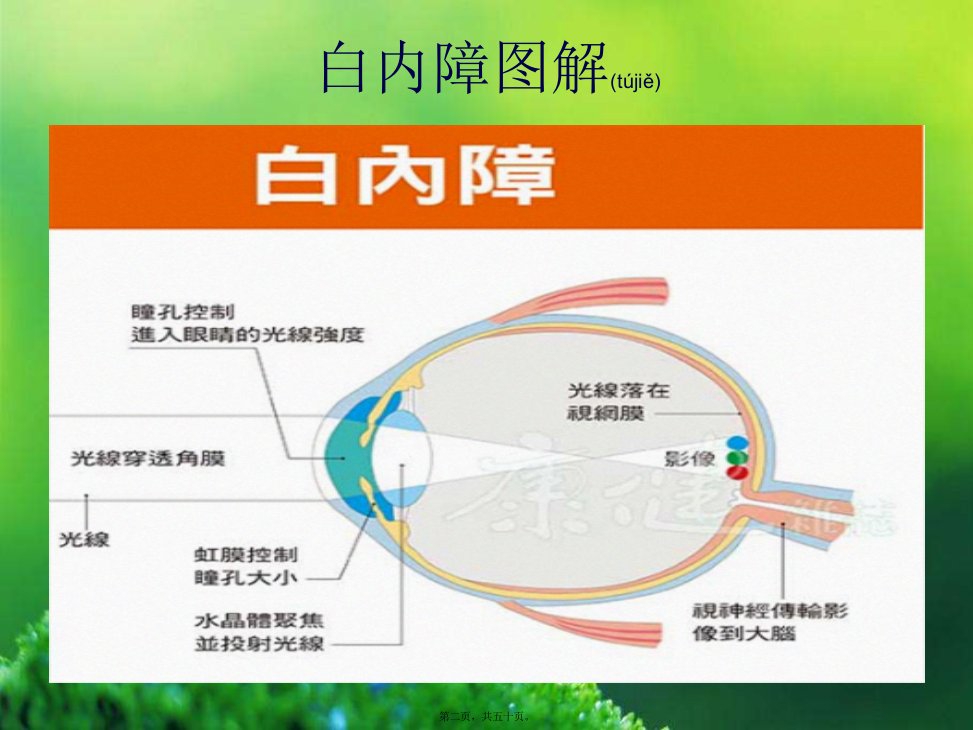 医学专题年龄相关性白内障