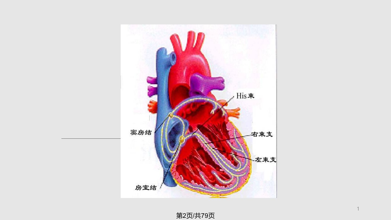 常见心律失常的心电图