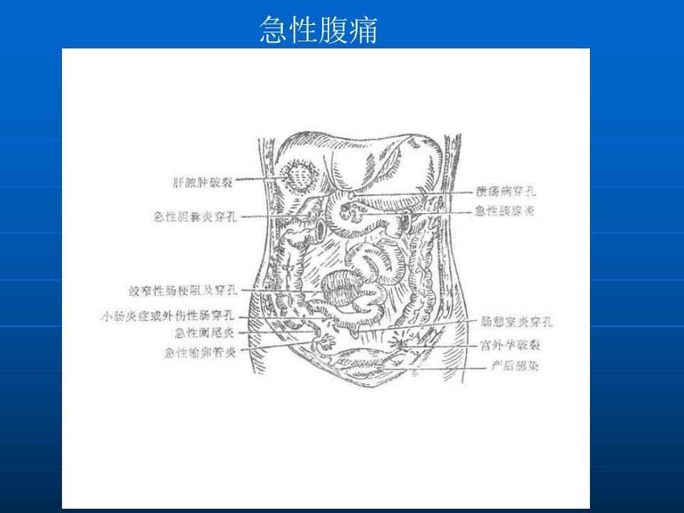 诊断学腹痛幻灯片