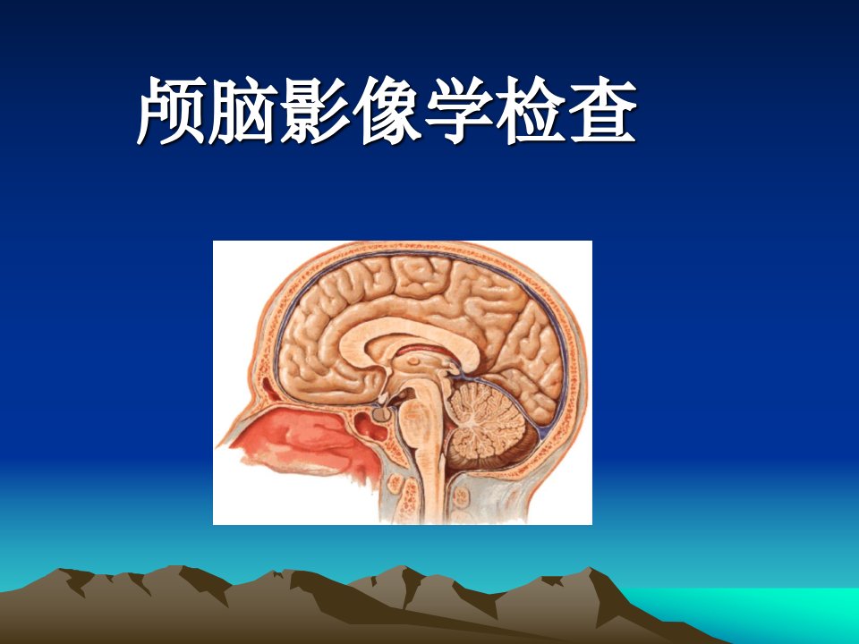 脑血管病的影像学检查