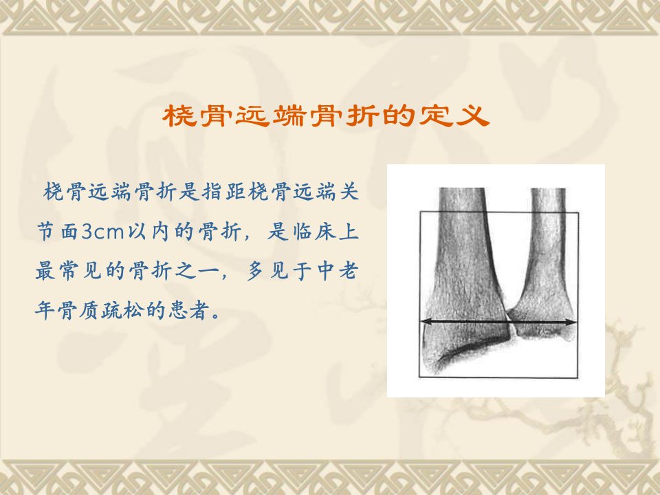 桡骨远端骨折ppt课件