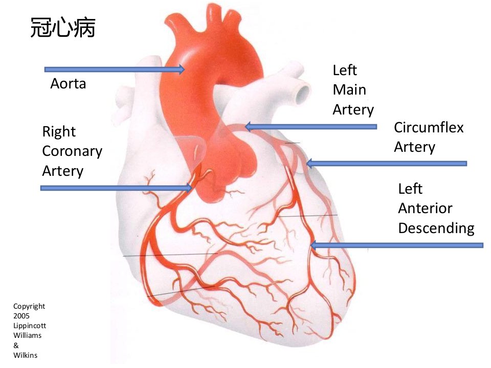 冠心病的临床用药综述ppt课件