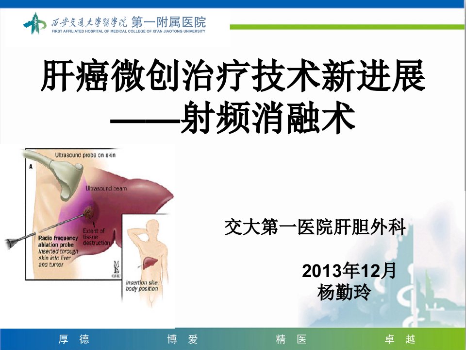 肝癌射频消融术-培训课件