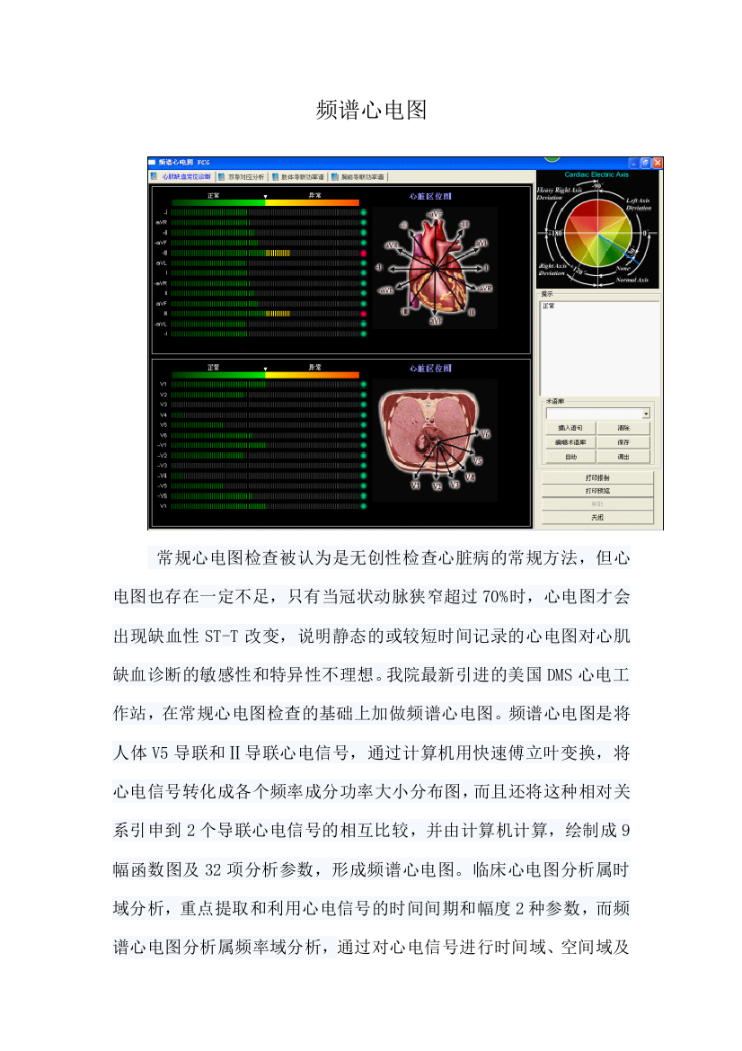 (完整word版)频谱心电图