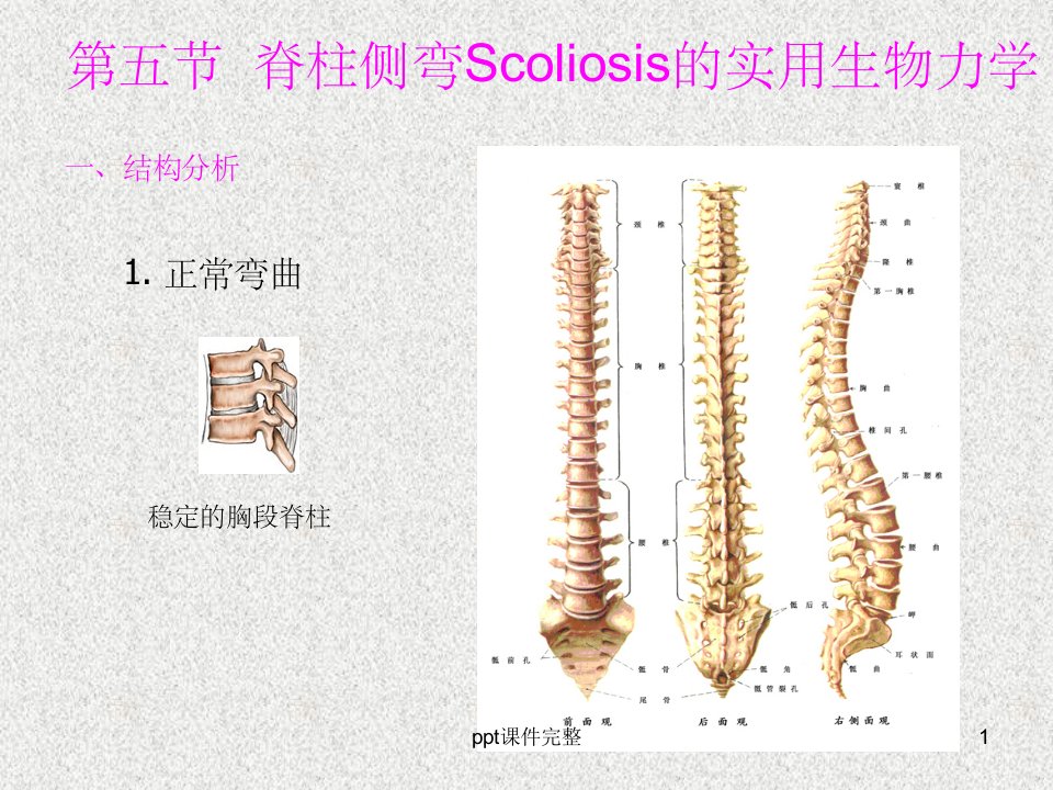 脊柱侧弯生物力学课件