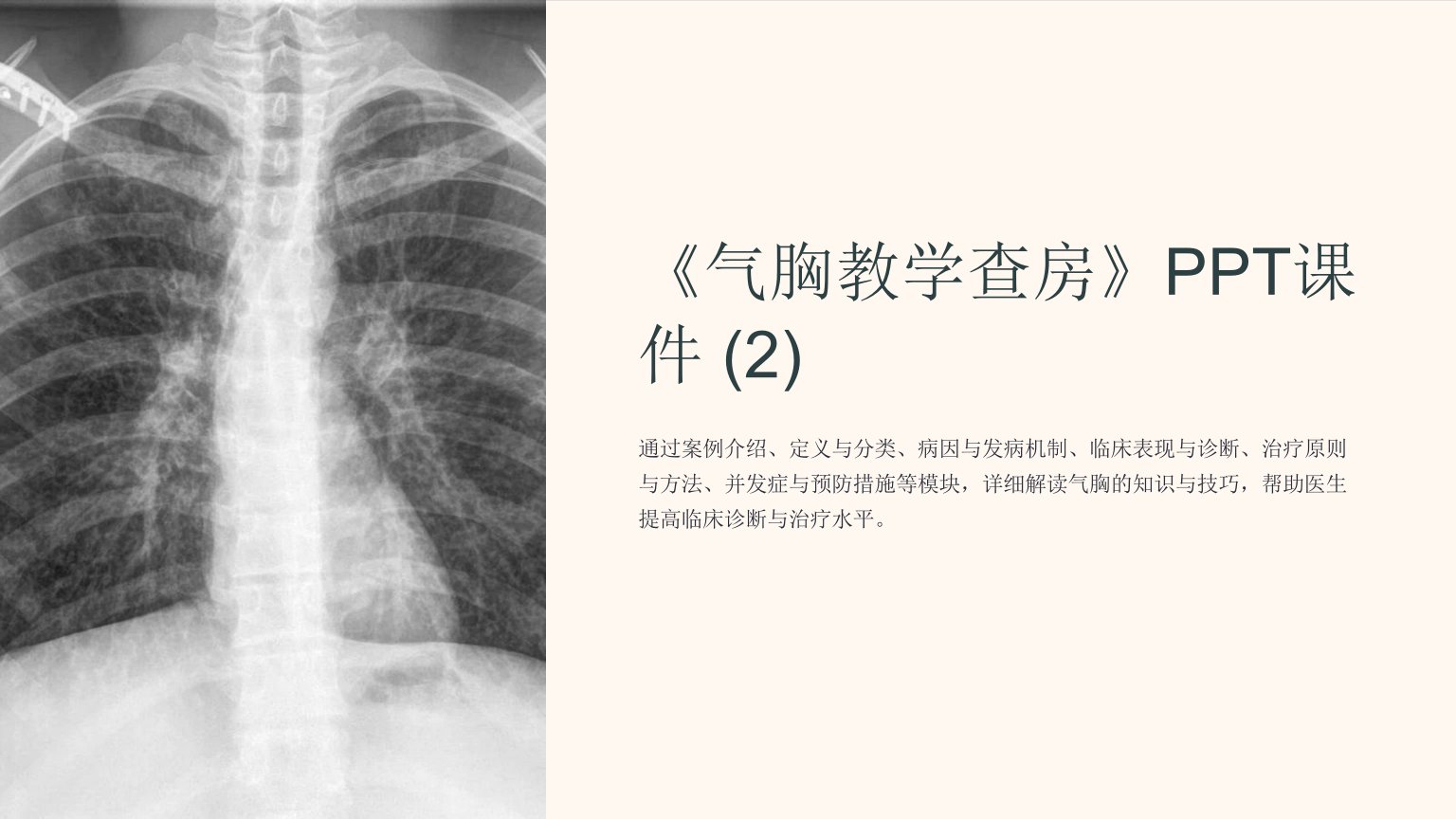 《气胸教学查房》课件