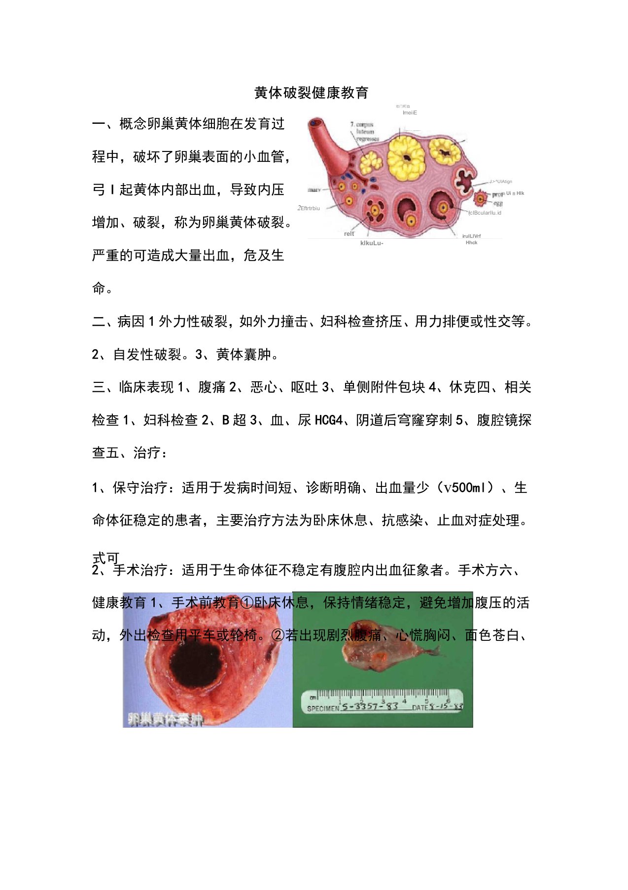 黄体破裂健康教育