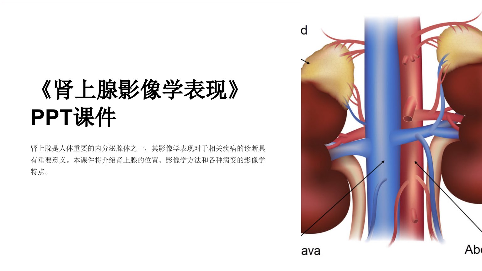 《肾上腺影像学表现》课件