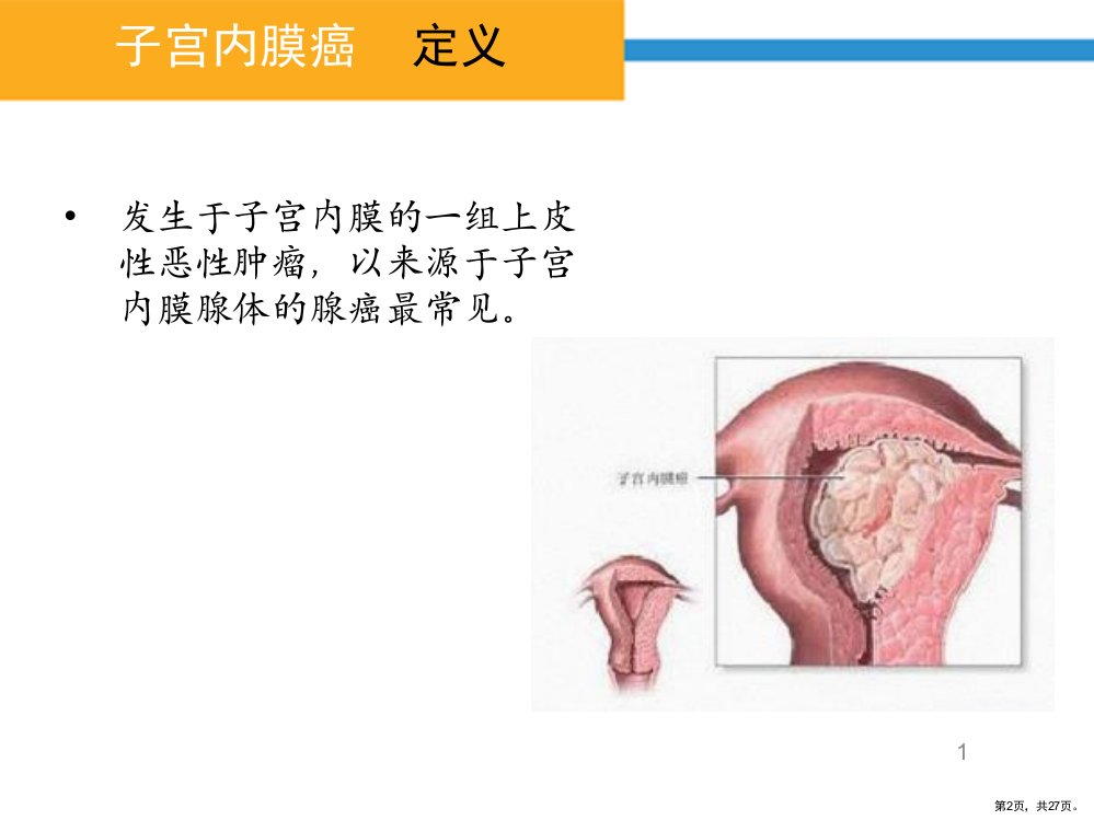 子宫内膜癌病人护理PPT参考幻灯片课件PPT27页