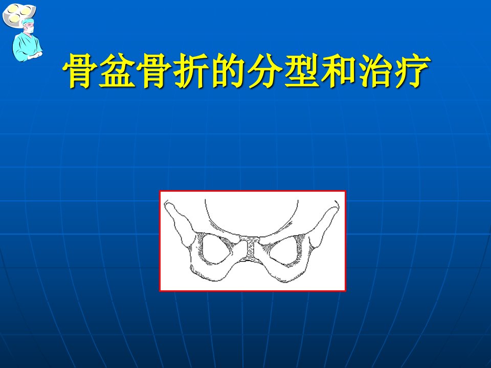 骨盆骨折的分型和治疗