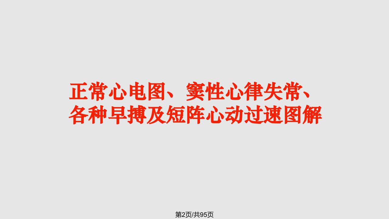 常见心电图诊断实习生之二