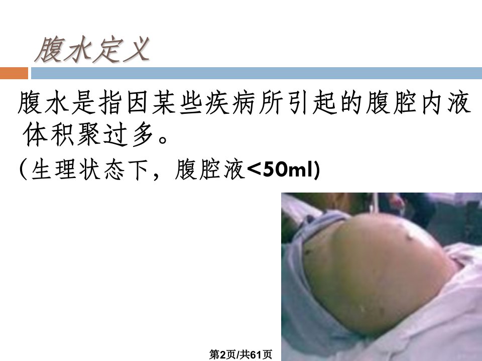 腹水查因临床诊断思路