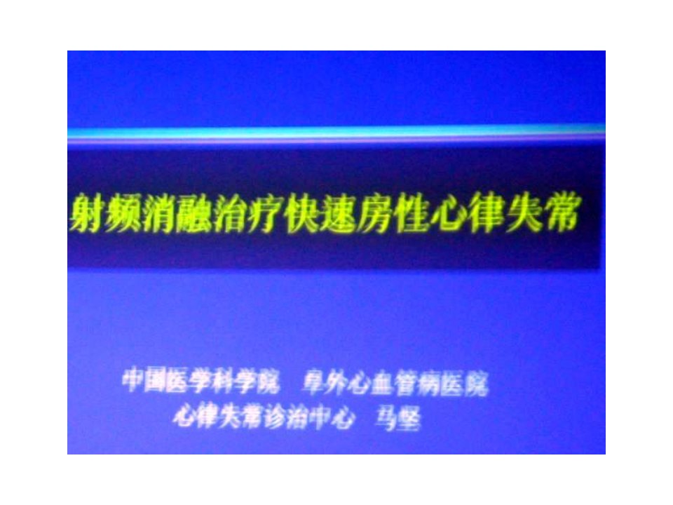 射频消融治疗快速房性心律失常