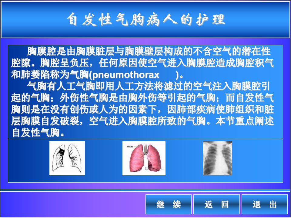 自发性气胸病人的护理