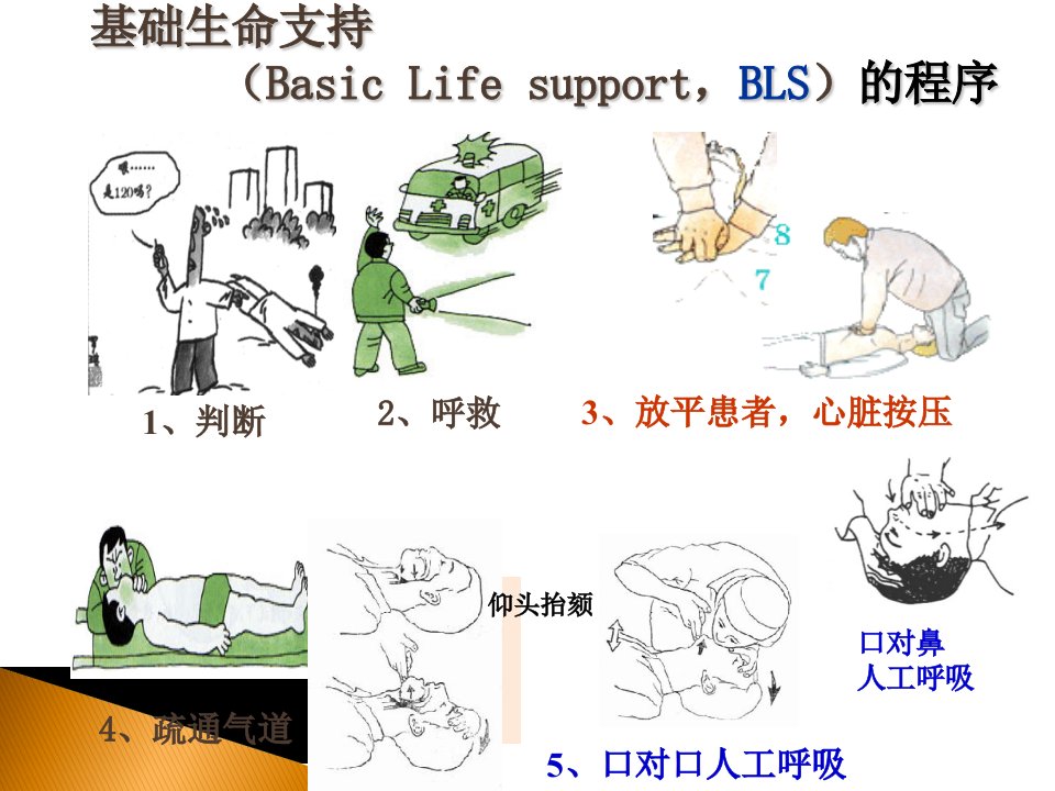 心脏骤停实例ppt课件