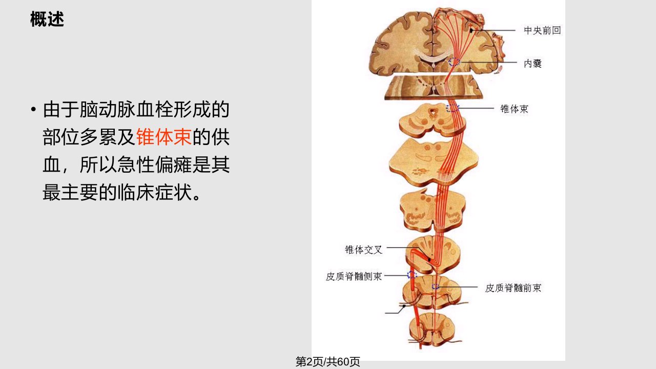 小儿急性偏瘫