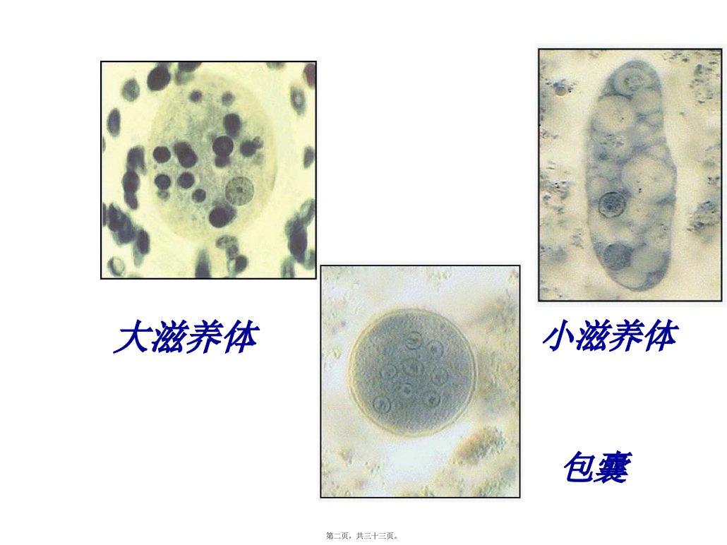 所有分类抗阿米巴虫驱肠虫药