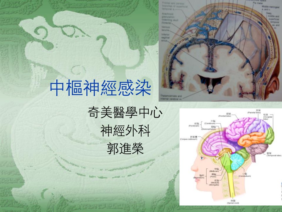 《中枢神经感染》PPT课件