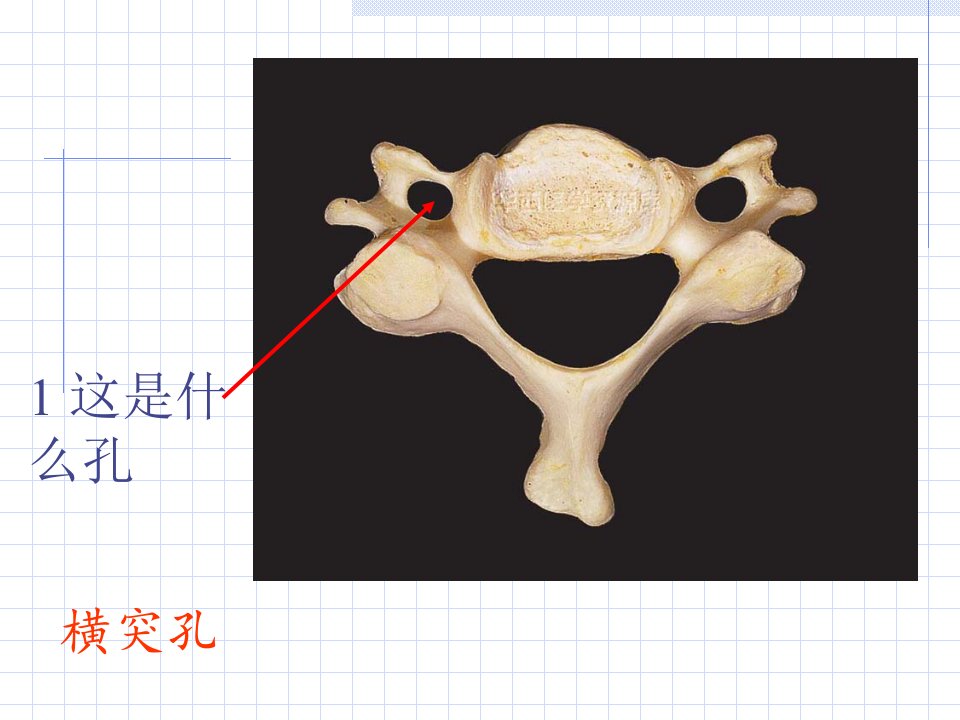 解剖标本考试