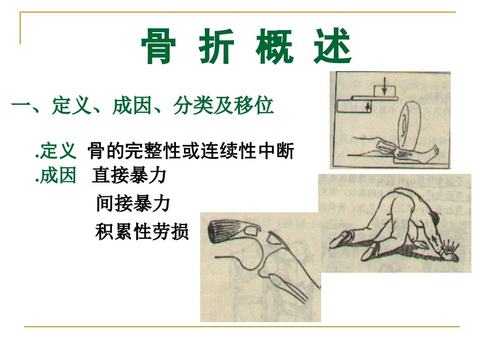 医学专题可出现前臂骨筋膜室综合征