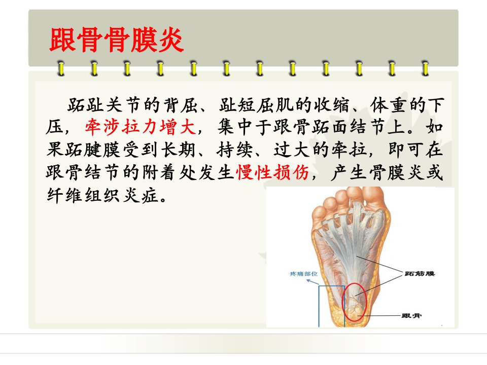 跟骨骨膜炎治疗方法