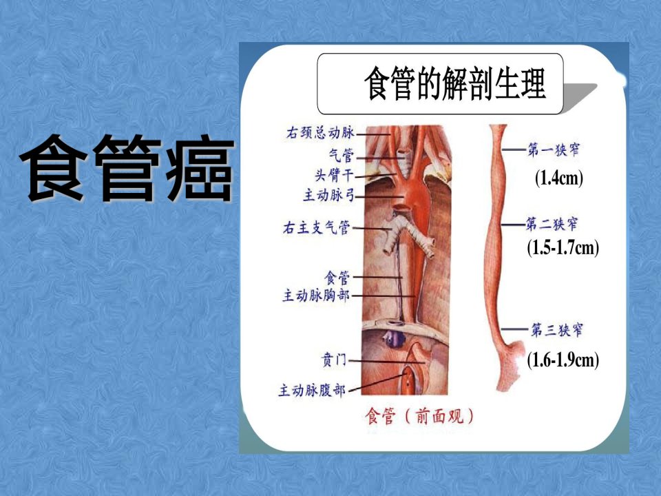 齐鲁医学F4食管癌病例讨论