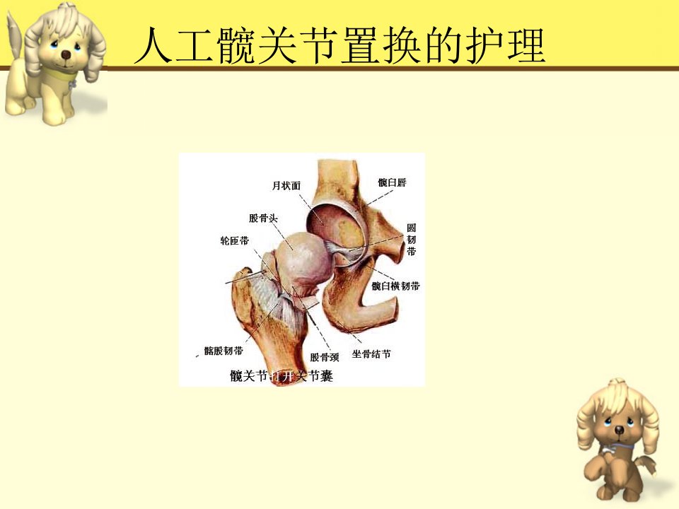 人工全髋关节置换