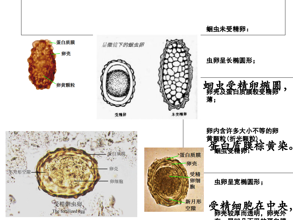 寄生虫学虫卵经典总结及图片-(yj)