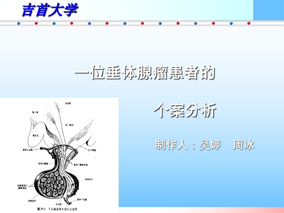 垂体腺瘤患者个案护理