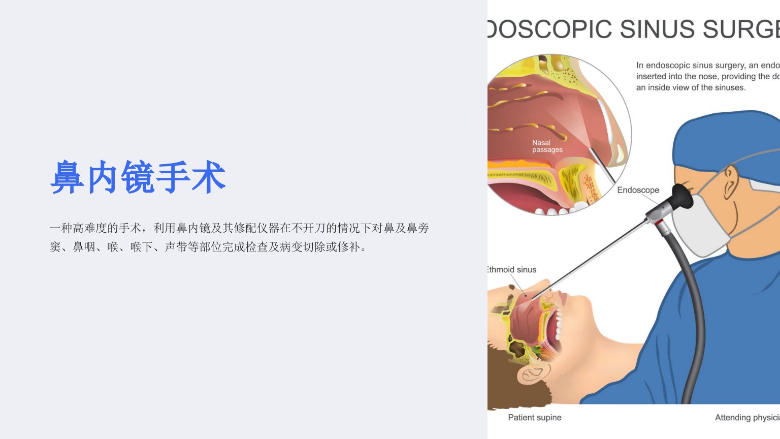 《鼻内镜手术》课件