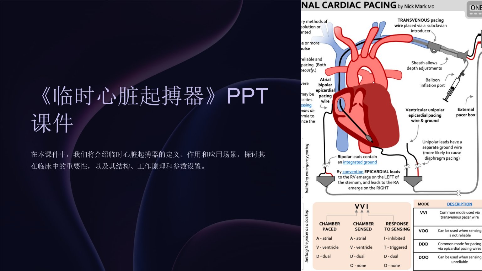 《临时心脏起搏器》课件