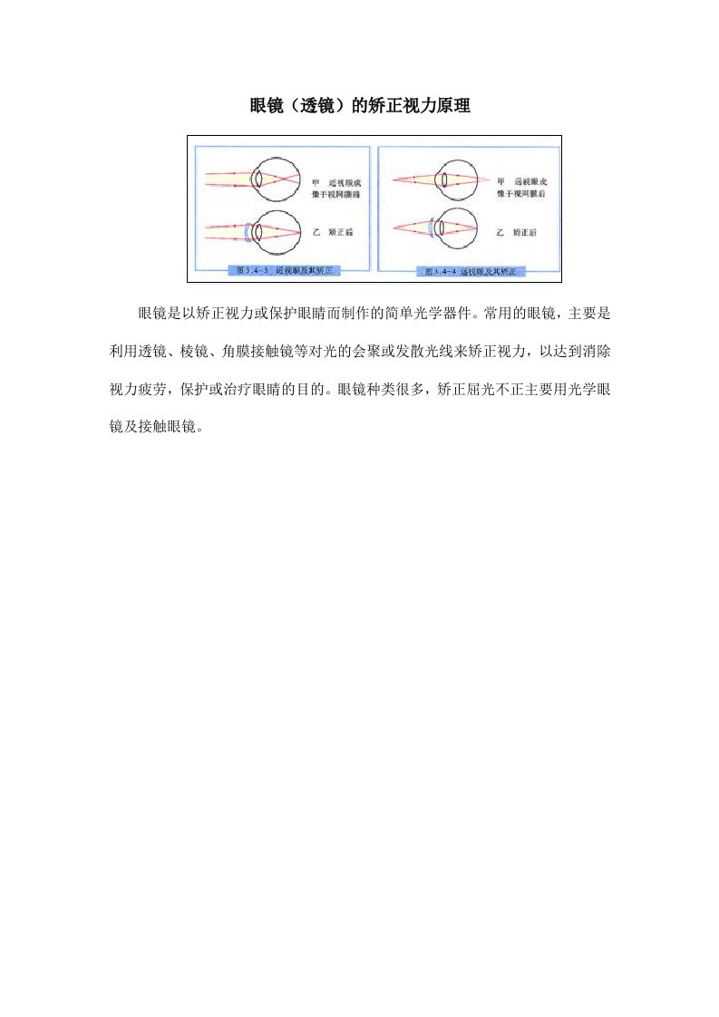 眼镜（透镜）的矫正视力原理