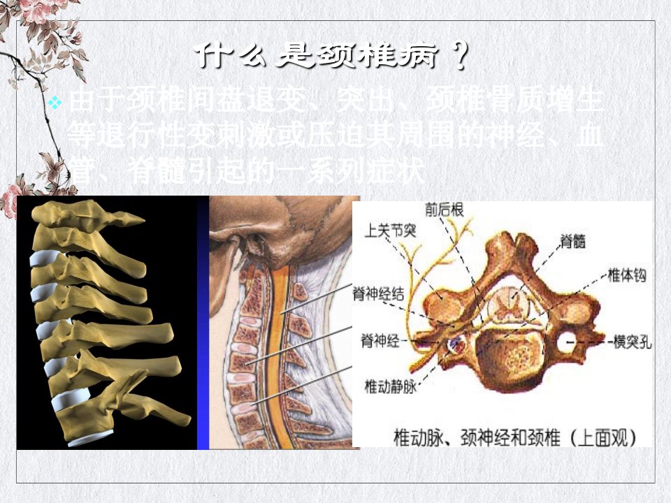 颈椎病分型及治疗讲课ppt课件