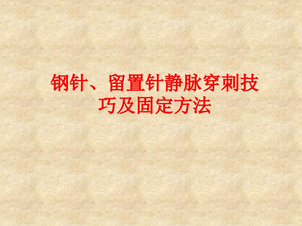 钢针、留置针静脉穿刺技巧及固定方法全