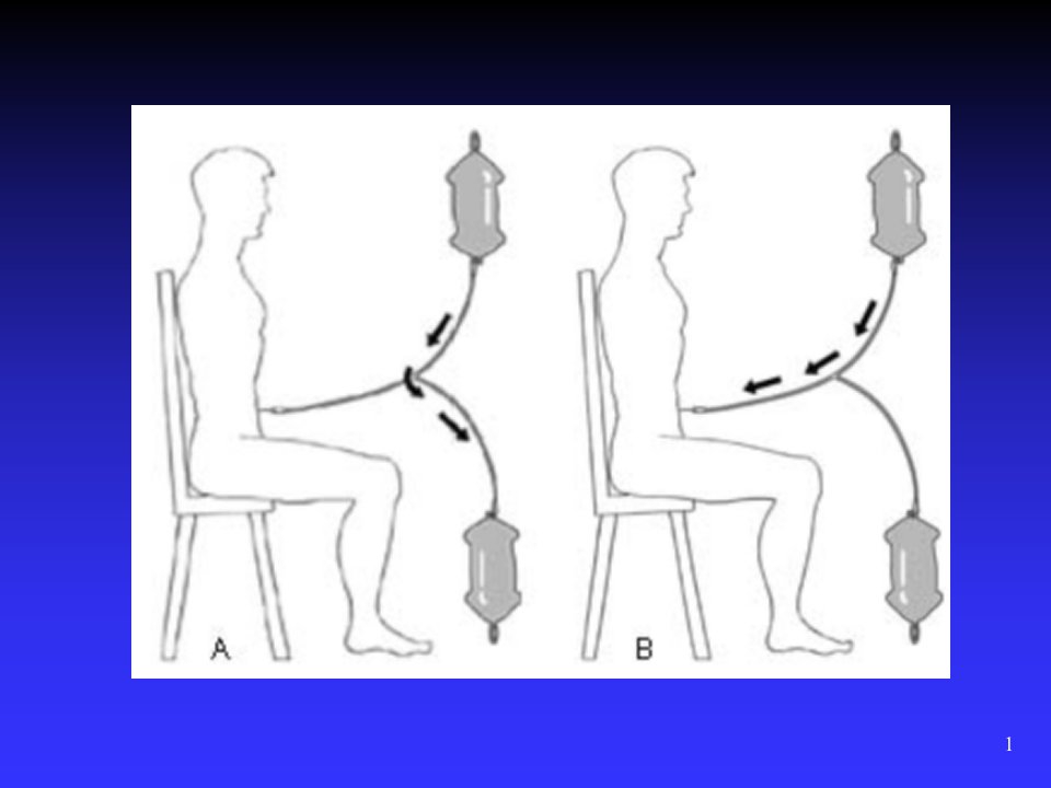 腹膜透析PPT课件