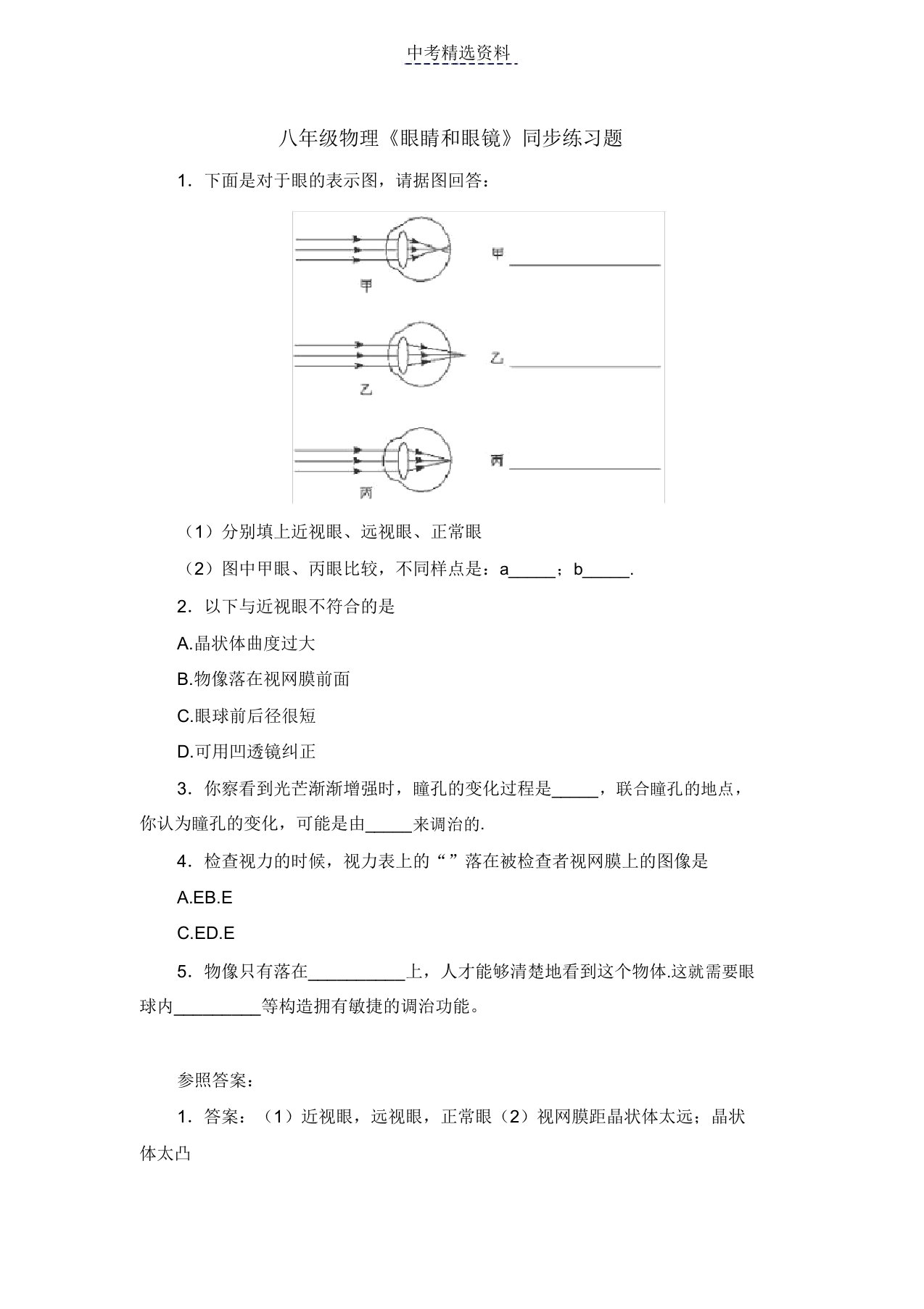 初中物理眼睛和眼镜练习及