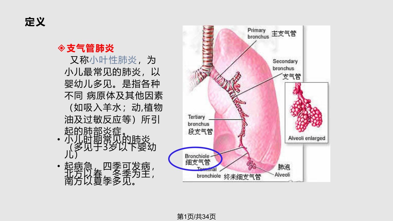 小儿支气管肺炎